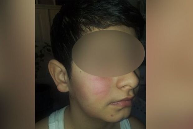 Qonşu 10 yaşlı uşağı vəhşicəsinə döyüb - İDDİA + FOTO/VİDEO