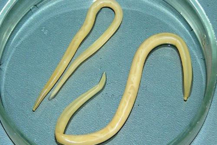 17 yaşlı qızın gözündən 12 santimetrlik QURD ÇIXARILDI