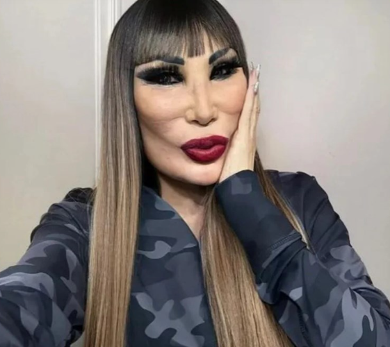 Məşhur aktrisa tanınmaz halda: Üzünə "yemək yağı" vurdurub