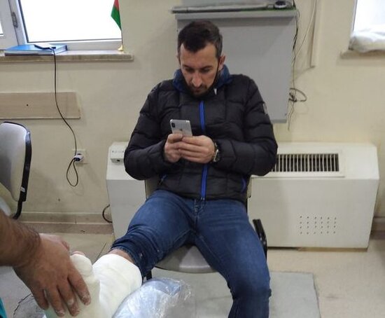 Vüqar Nadirovun ayağı gipsə qoyuldu: "Bu, sınıqdan da betərdir" - FOTO
