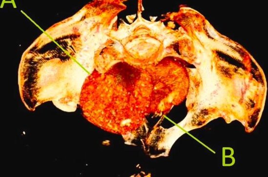 "Lənətlənmiş" mumiya açıldı: 2000 ildir bətndə çürüməyən döl... - Şok araşdırma