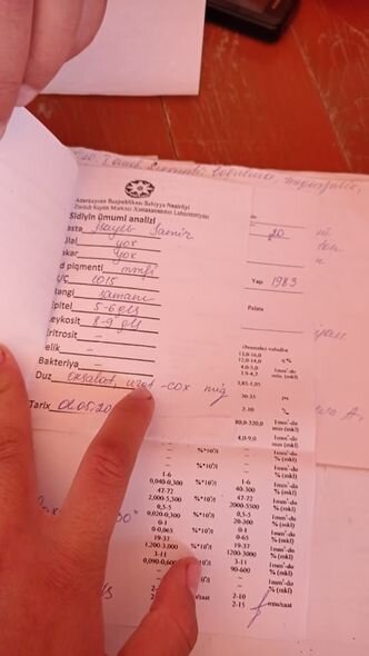 Məktəbli atasına dərman almaq üçün pambıq toplayır - FOTO