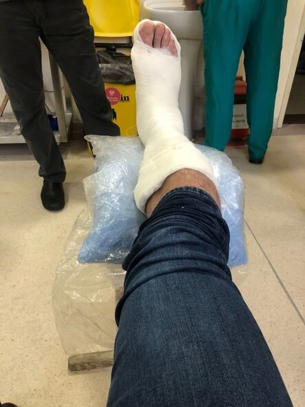 Vüqar Nadirovun ayağı gipsə qoyuldu: "Bu, sınıqdan da betərdir" - FOTO