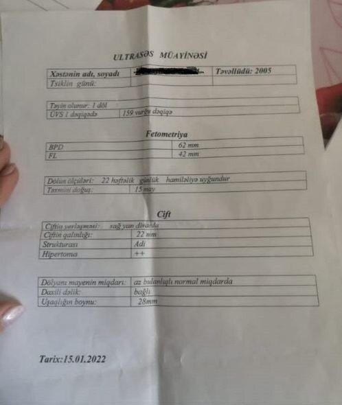 Azərbaycanda 70 yaşlı kişi 17 yaşlı qızı zorladı - YENİLƏNİB + FOTO/VİDEO