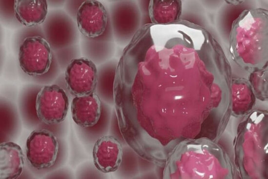 Xərçəngin yeni müalicə üsulu TAPILDI