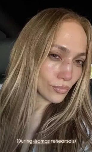 Jennifer Lopez məşhur mükafat şousunun məşqləri zamanı üzündən xəsarət aldı - FOTO