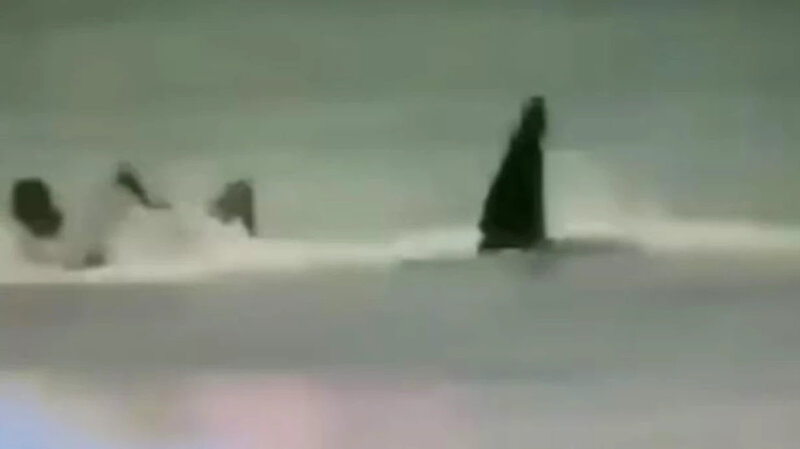 Köpək balığı peşəkar sörfçüyə hücum edərək ayağını qopardı