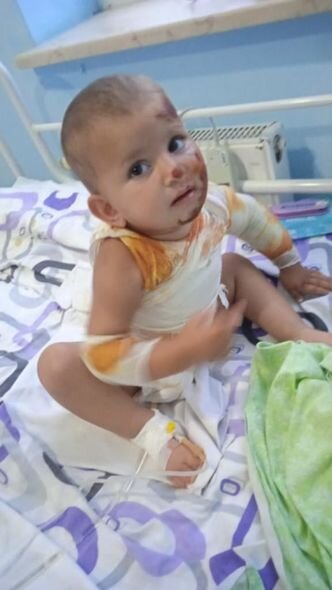 Balaca Zəhranın anası fəryad edir: "Bint almağa pulum yoxdur, sarğılarını 4 gündür dəyişə bilmirəm" - FOTO