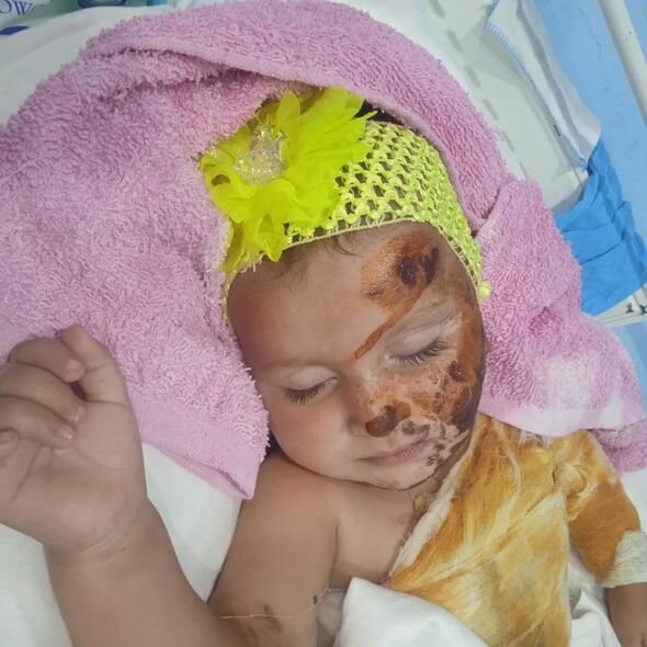 Balaca Zəhranın anası fəryad edir: "Bint almağa pulum yoxdur, sarğılarını 4 gündür dəyişə bilmirəm" - FOTO