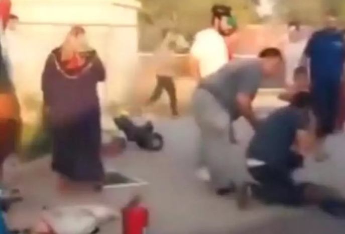 Konteyner yandı: 1 uşaq yaralandı