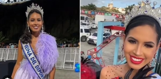 Gözəllik müsaqibəsinin qalibi estetik əməliyyatdan sonra öldü