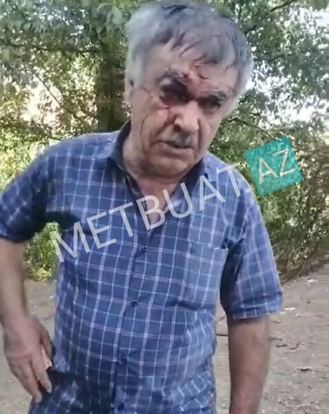 Ziyarətdən qayıdarkən qəzada ölən qadınların və sürücünün FOTOLARI